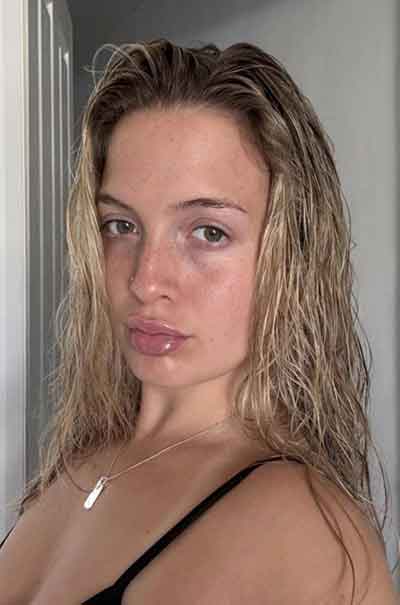 Linnea, 32 år
